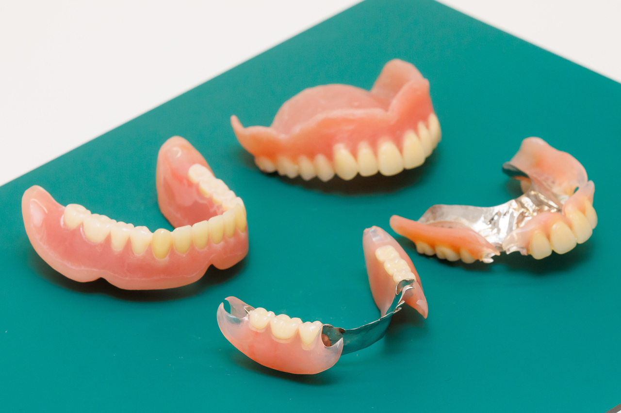 入れ歯の治療